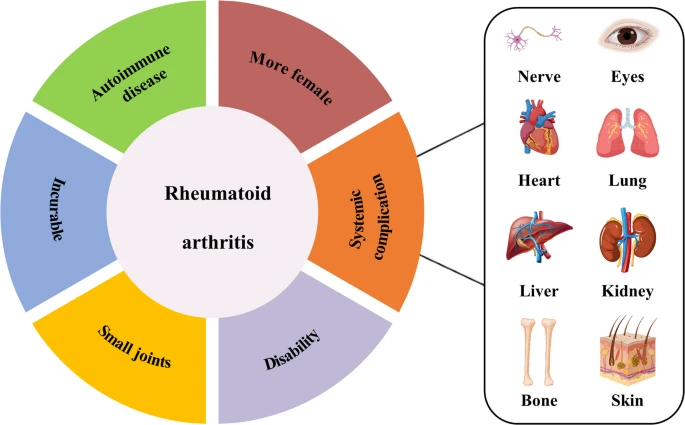 圖1:類風濕性關節炎的一般特征。 圖1:類風濕性關節炎的一般特征。