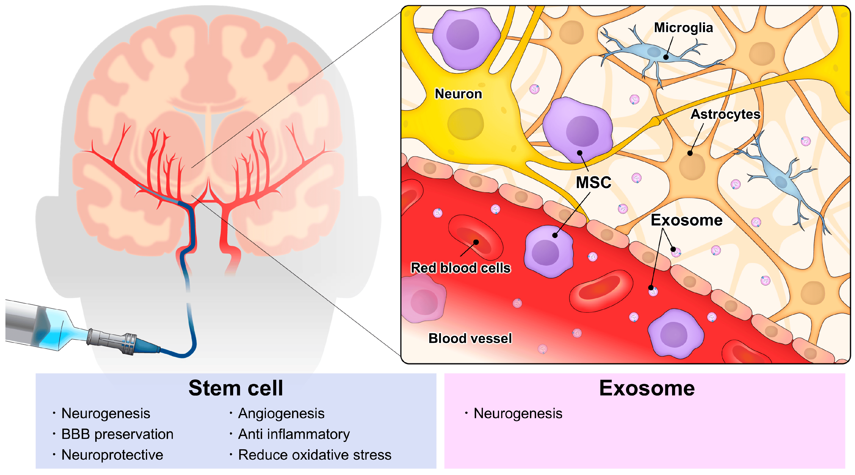 動脈注射干細(xì)胞&外泌體治療神經(jīng)系統(tǒng)疾病，打多少細(xì)胞好？