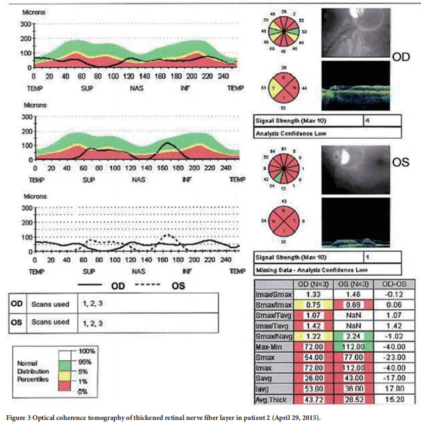 遺傳性視神經病變臨床試驗