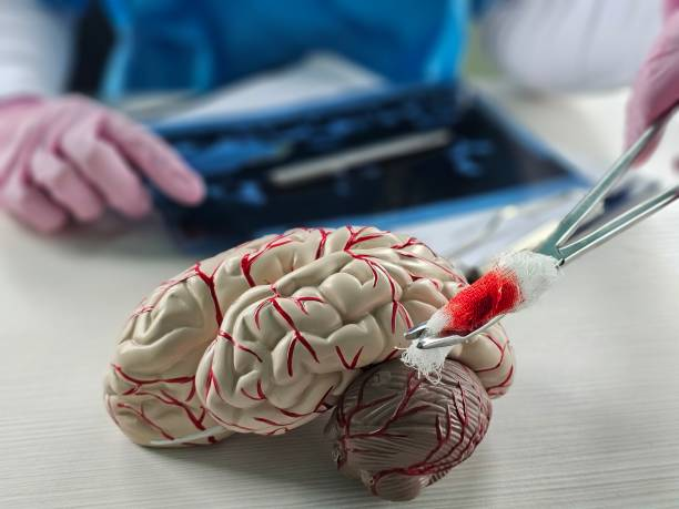 “開關(guān)現(xiàn)象”能解決？干細(xì)胞為帕金森病治療帶來新希望