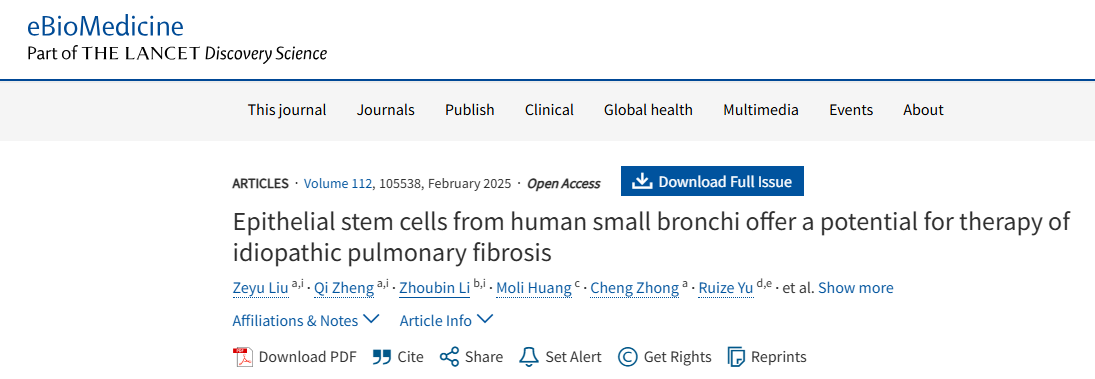 人類小支氣管上皮干細胞為治療特發性肺纖維化提供了潛力