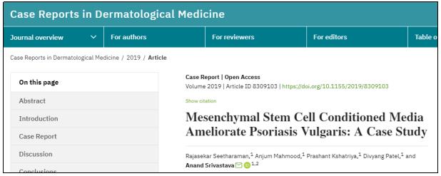 間充質干細胞條件培養基改善尋常型銀屑病:案例研究 間充質干細胞條件培養基改善尋常型銀屑病:案例研究