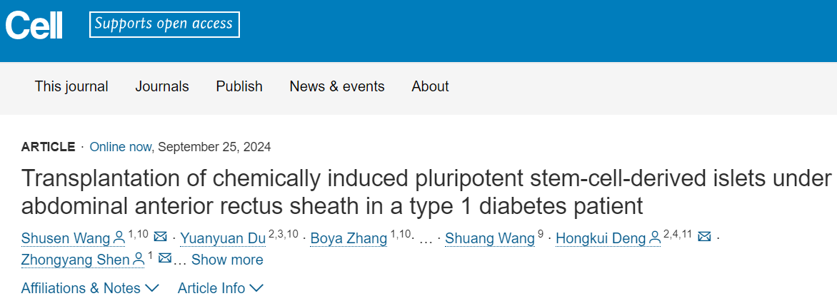 在一名1型糖尿病患者腹部前直肌鞘下移植化學誘導的多能干細胞來源胰島