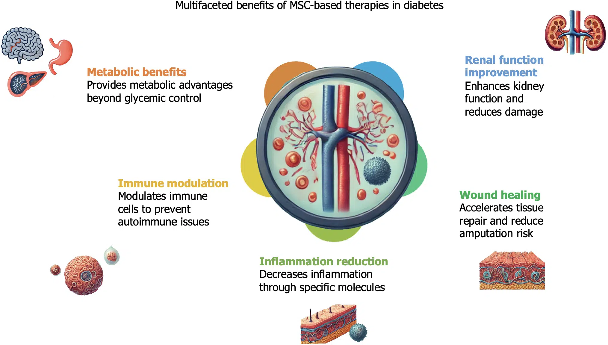 基于間充質干細胞的療法對糖尿病患者的各種非血糖效應