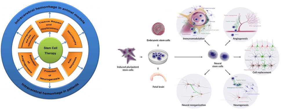 干細胞和神經干細胞在腦出血中的治療機制