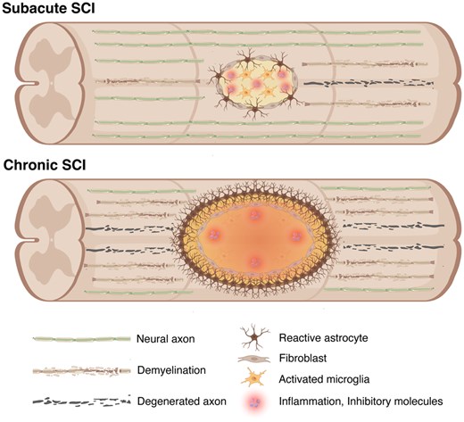 圖2:脊髓損傷后亞急性期和慢性期的病理特征。 圖2:脊髓損傷后亞急性期和慢性期的病理特征。
