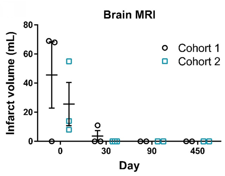 圖3：腦部MRI梗死體積測量。代表性MRI圖像顯示了患者從篩查到第450天的腦梗死體積。圖中顯示了患者在篩查（第0天）、治療后（第30天和第90天）以及隨訪（第450天）時的梗死體積。