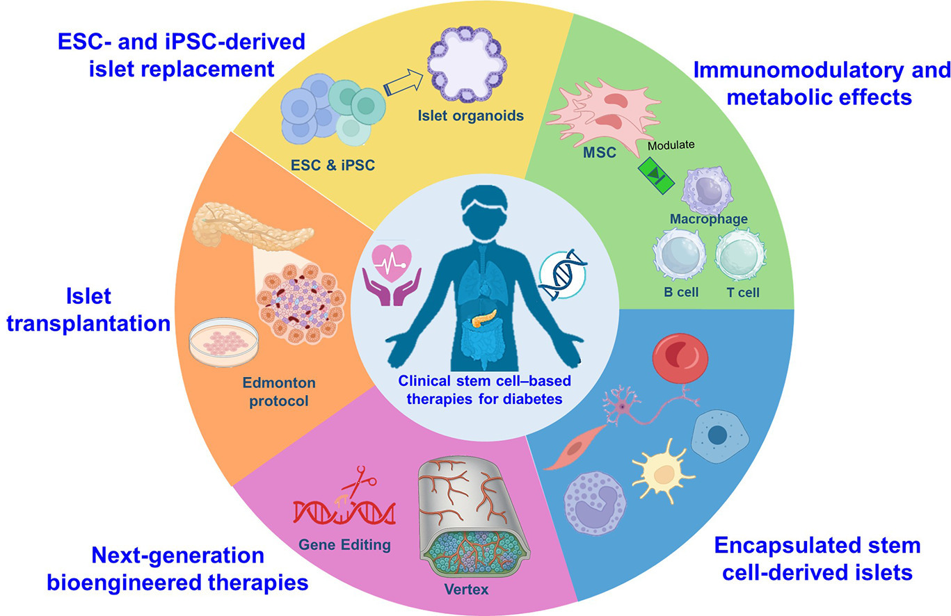 干細胞療法重塑糖尿病治療格局——主要臨床試驗概述與未來展望